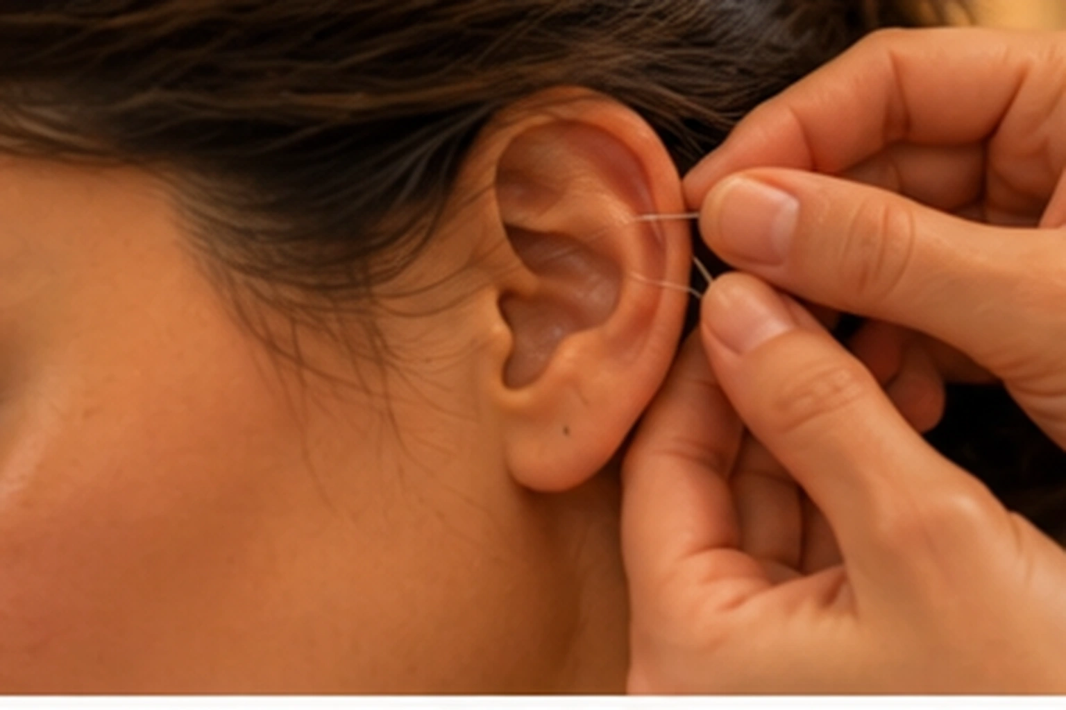 Auriculoterapia